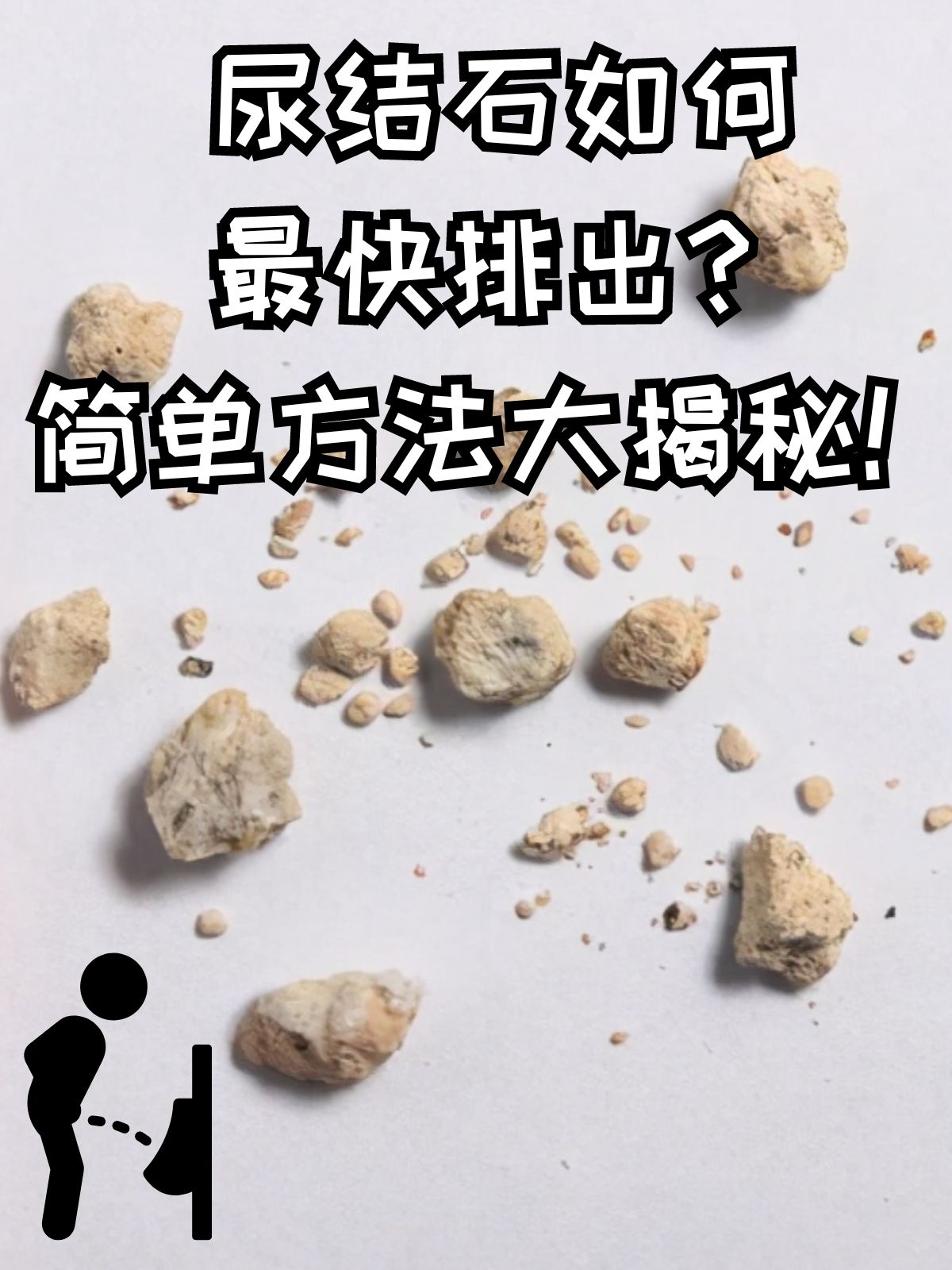 肾结石最好的治疗方法