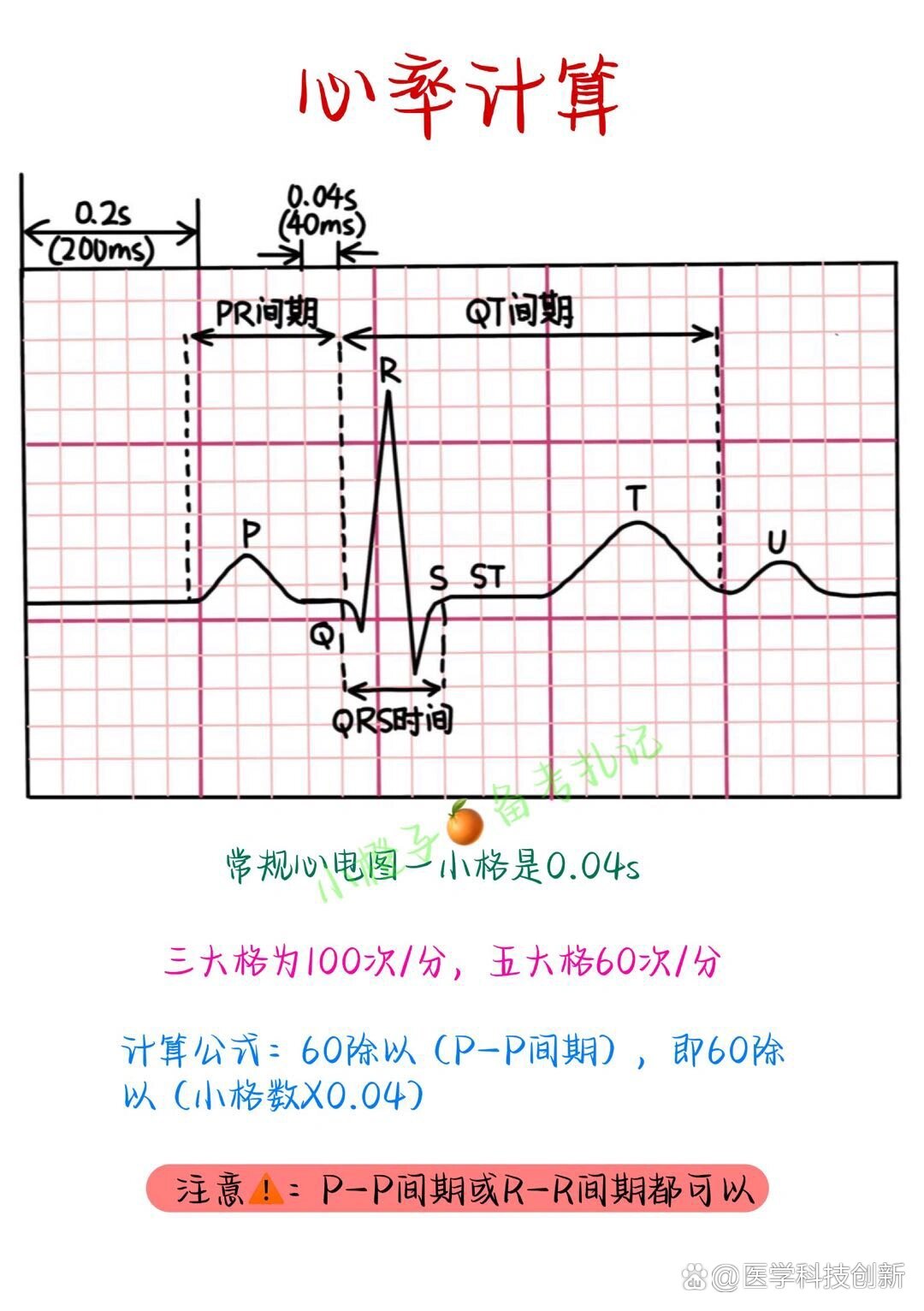 心电图pr间期正常值