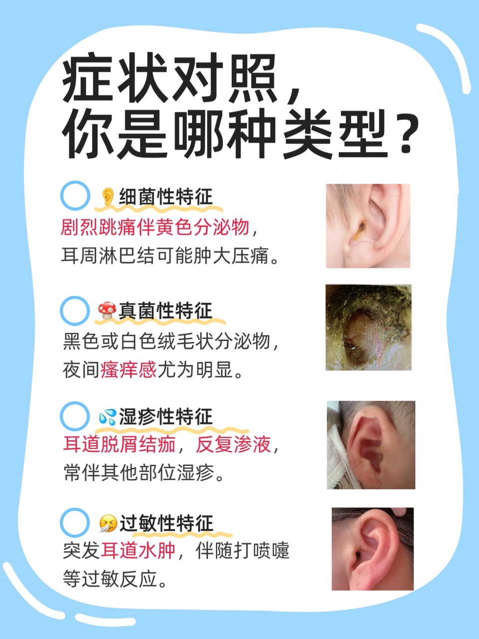 外耳炎是由什么原因引起的