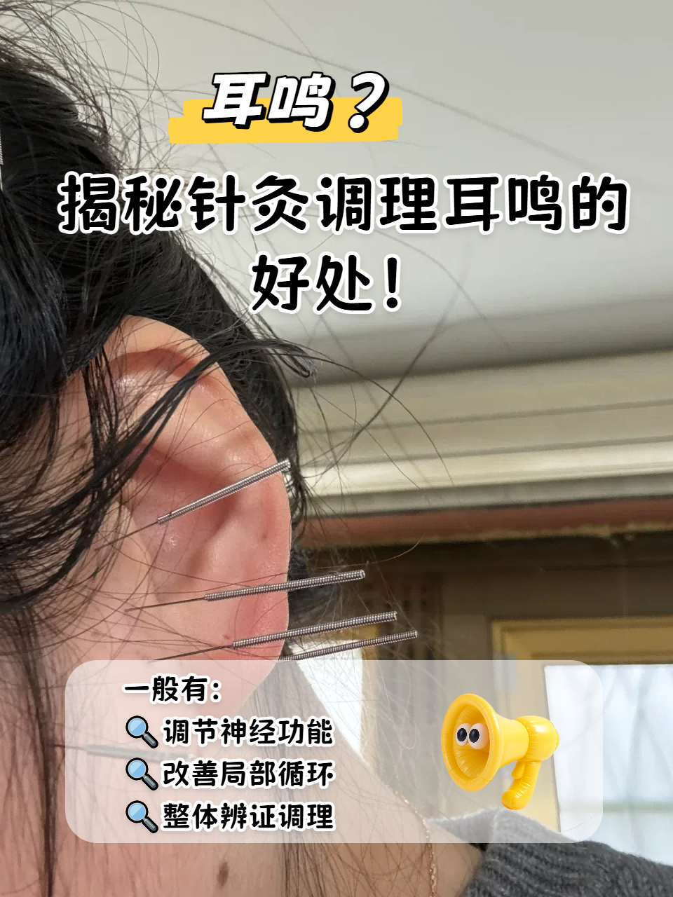 耳鸣怎么中医治疗
