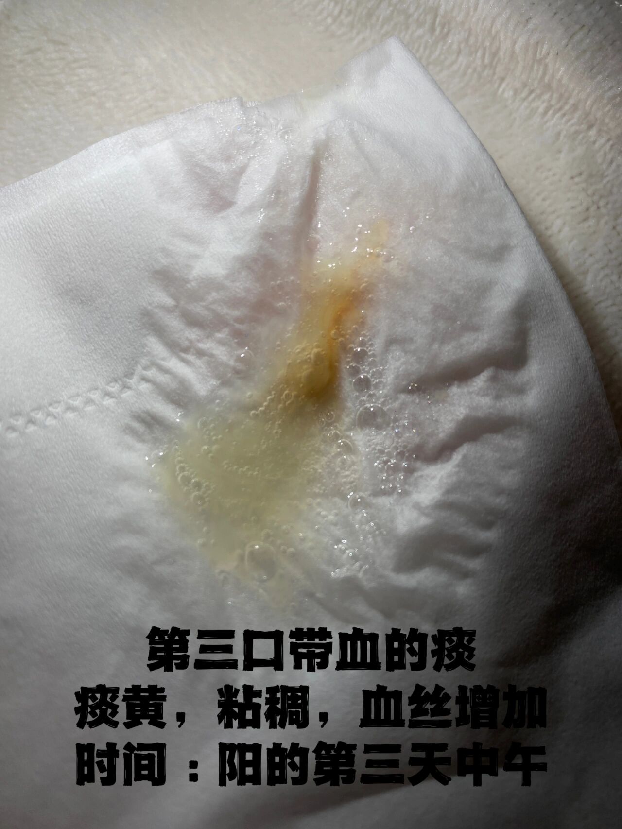 鼻子里出来的痰有血是怎么回事