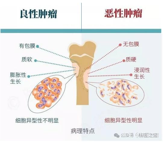 怎样鉴别良恶性肿瘤