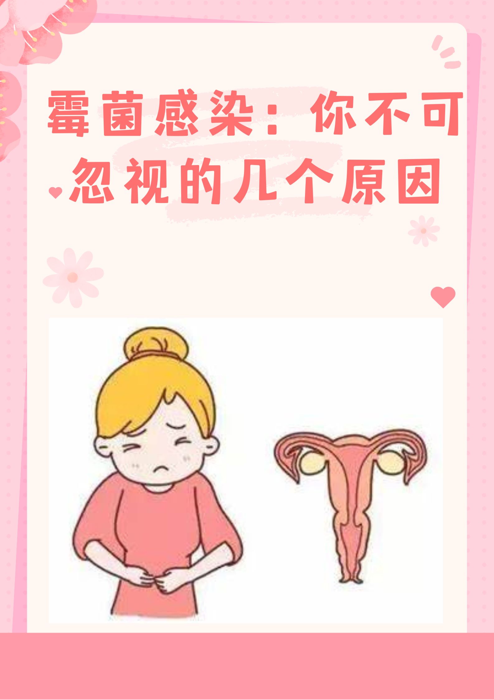 霉菌感染和老公有关吗