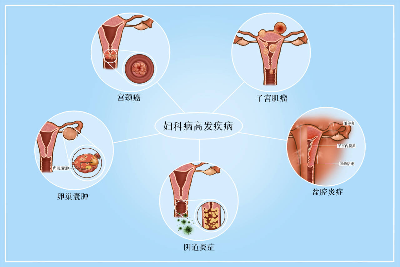 宫颈在哪个部位图片