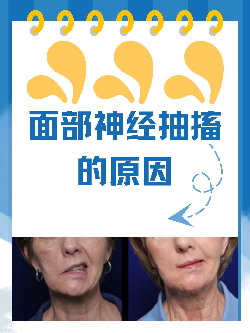 头部神经一抽一抽的疼是怎么回事