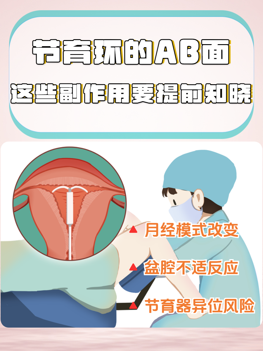 节育环副作用是什么