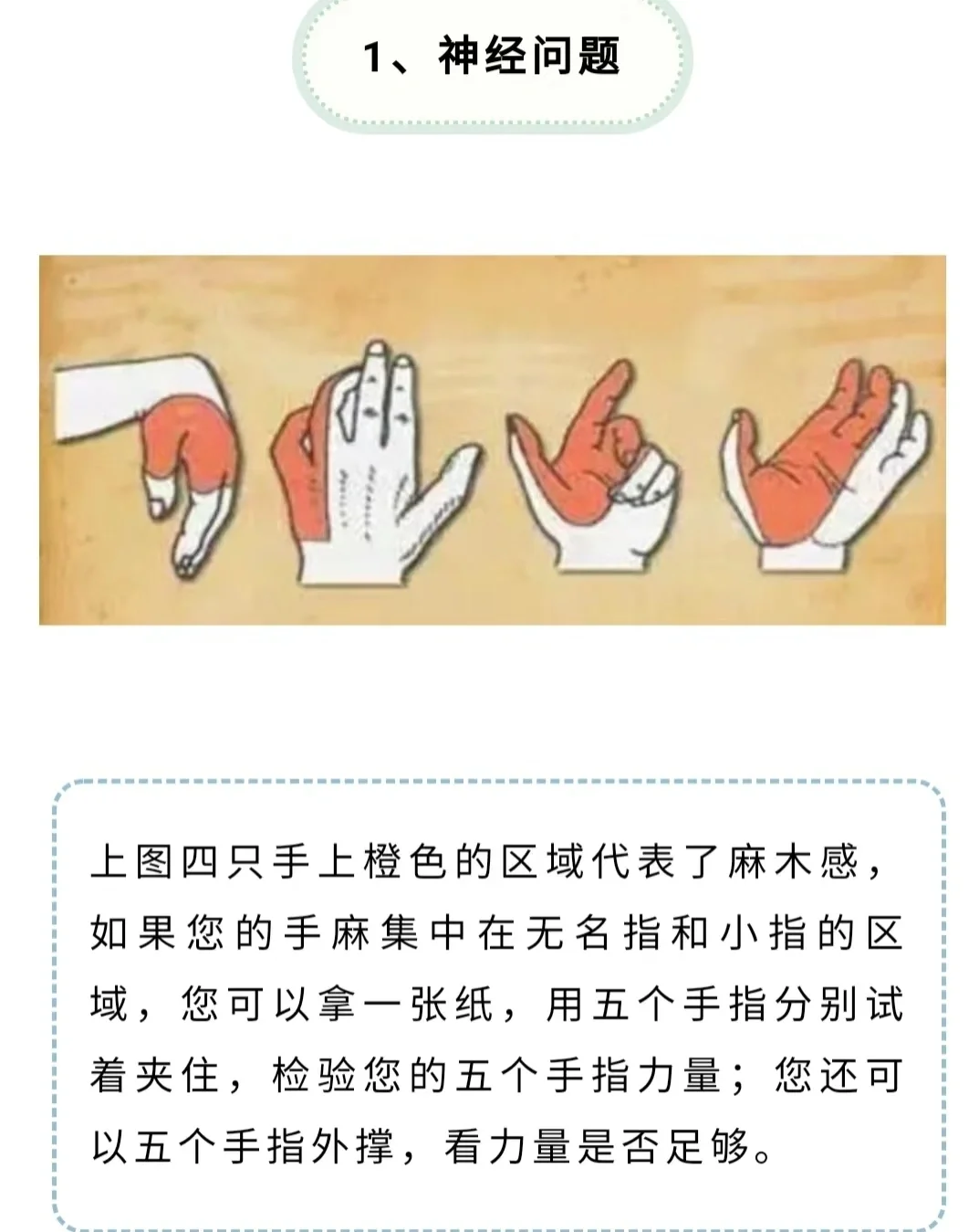 手发麻是怎么回事