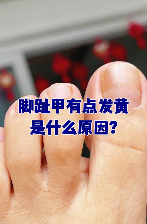 手指甲发黄是怎么回事