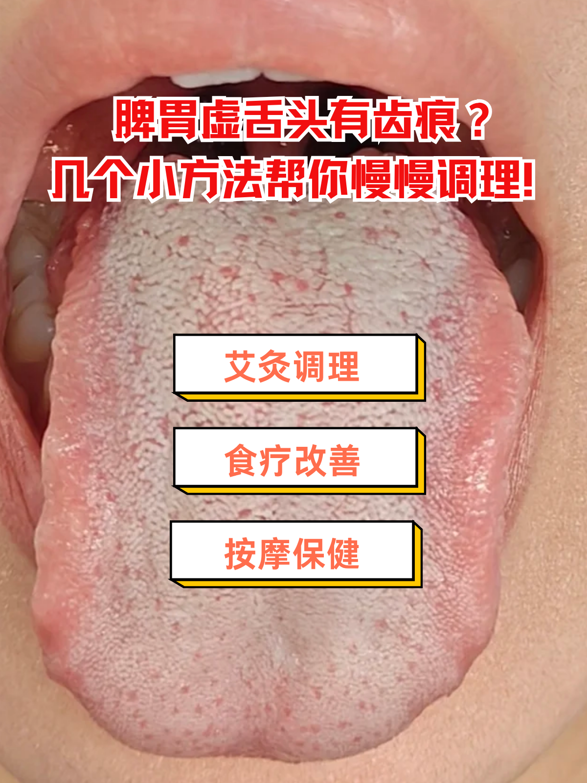 舌头两边有齿痕是什么原因?