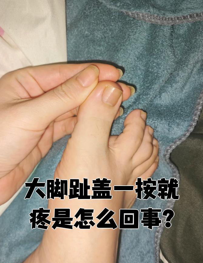 大母脚趾疼是痛风吗?