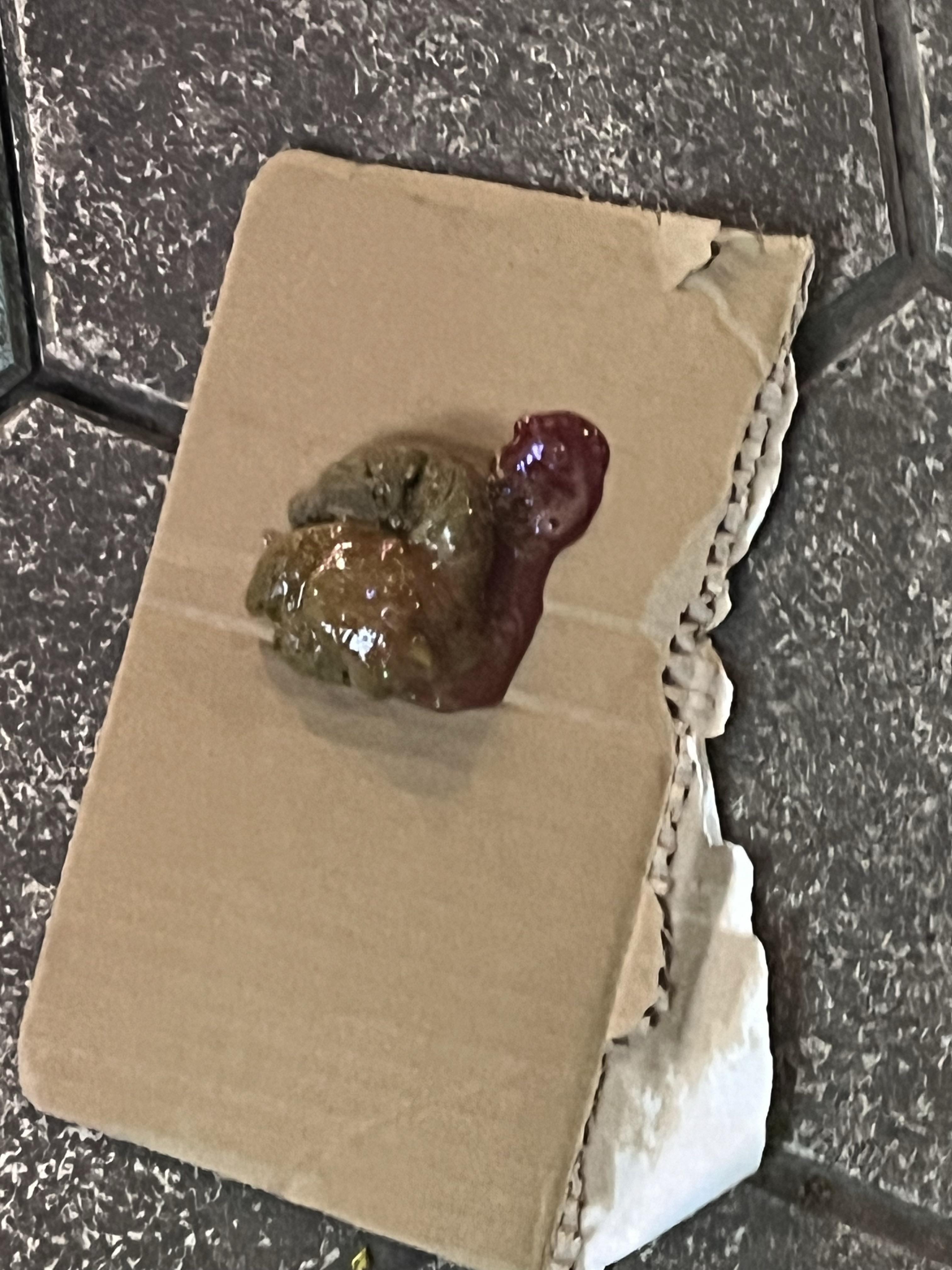 大便拉到一半拉不出来