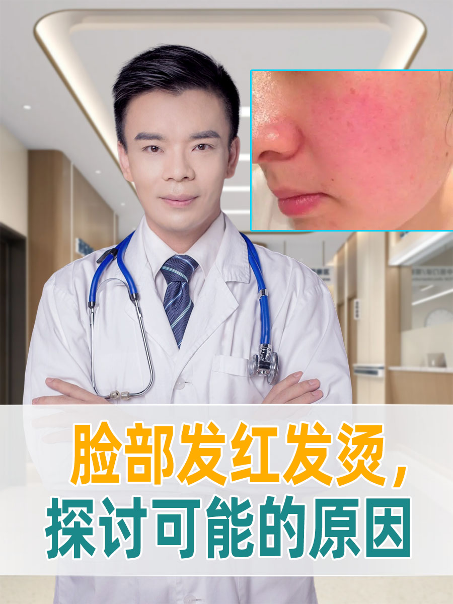 脸部发烫,但不发烧是怎么回事?