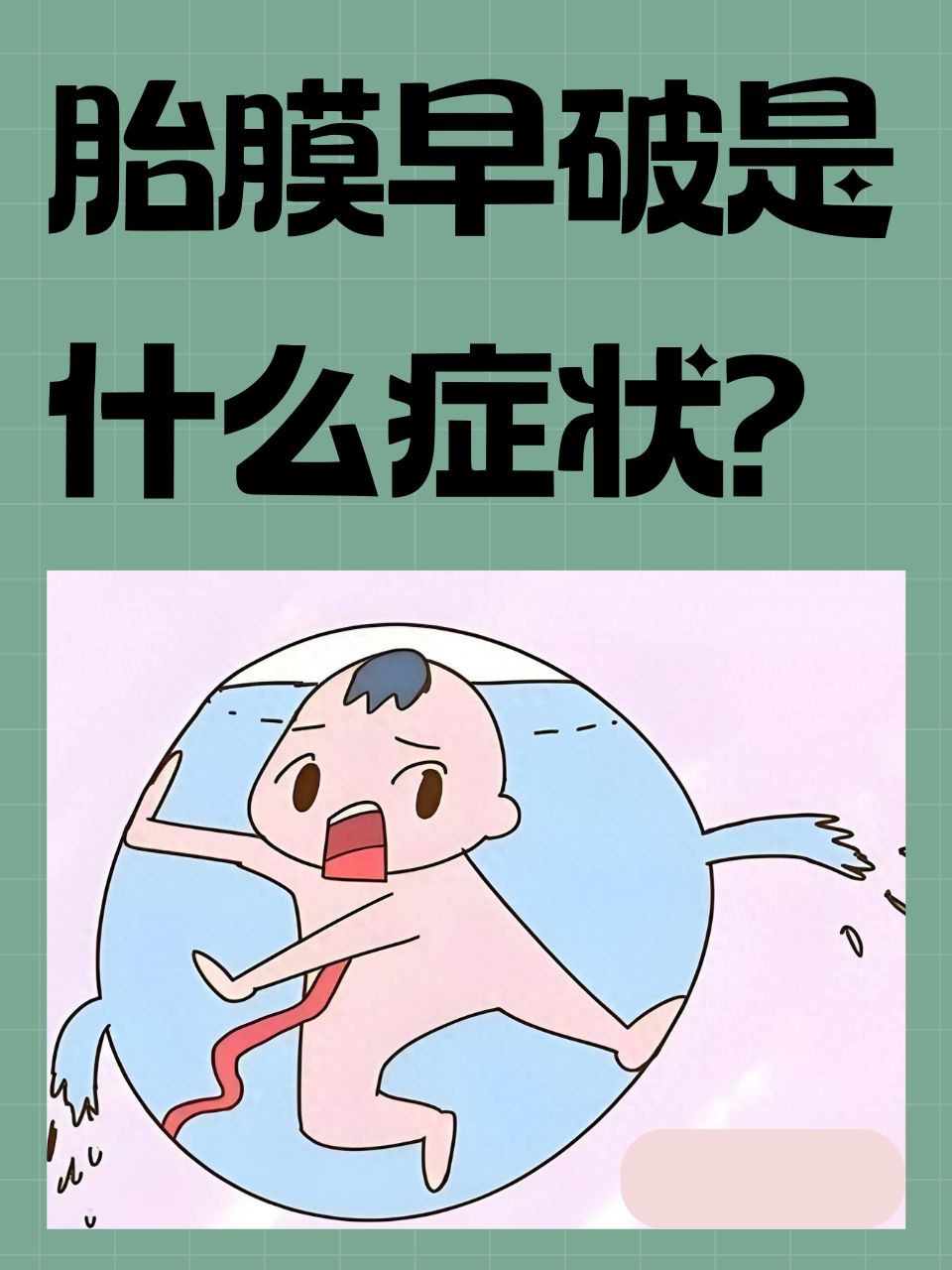 胎膜早破的护理措施有哪些