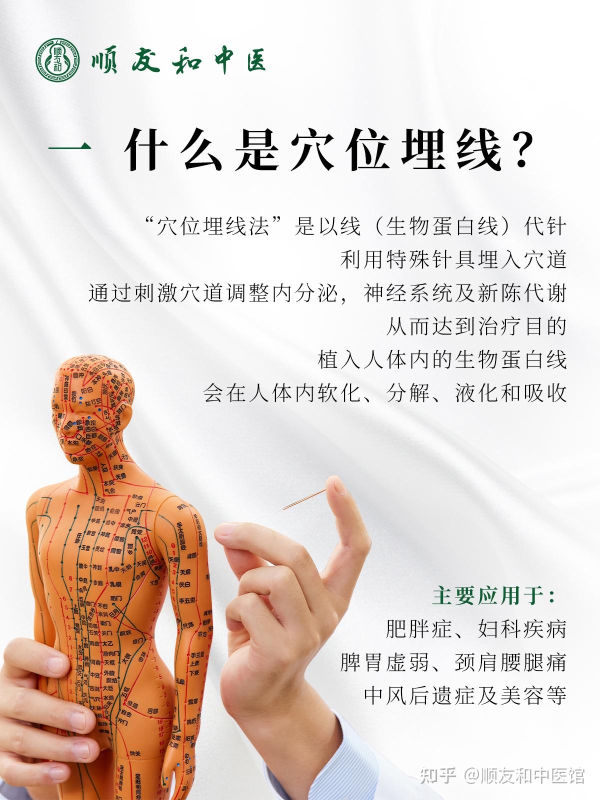 什么是穴位埋线?