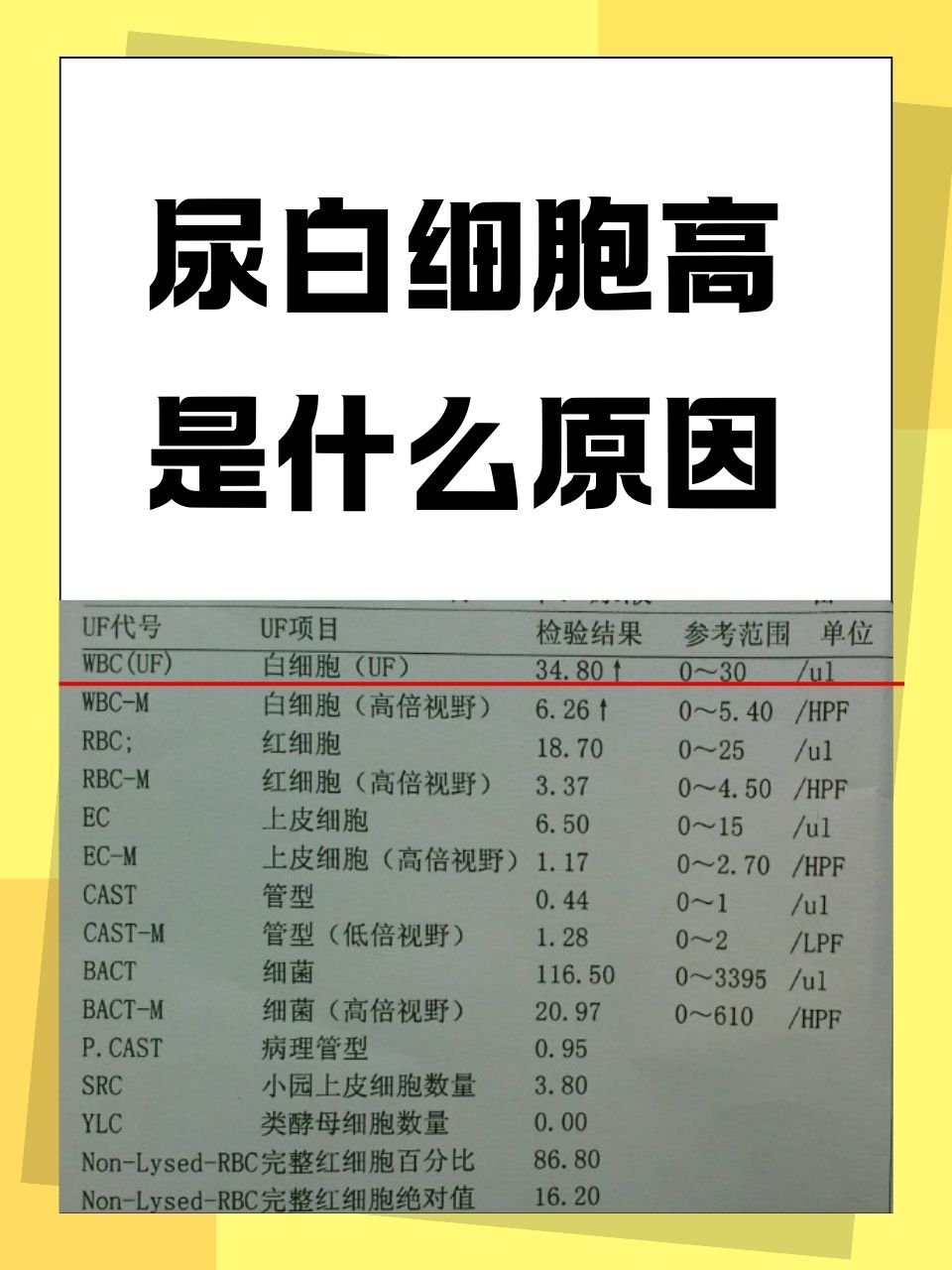 尿液检查白细胞