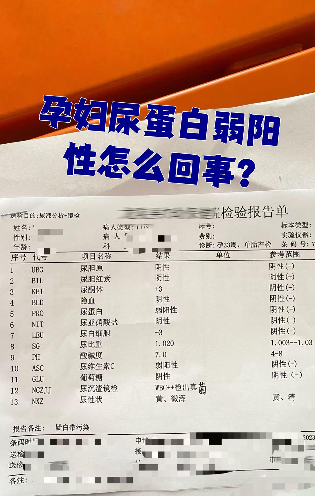 尿常规检查要空腹检查吗?