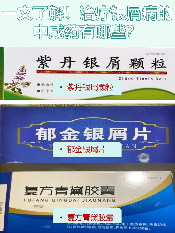 银屑病用什么药?