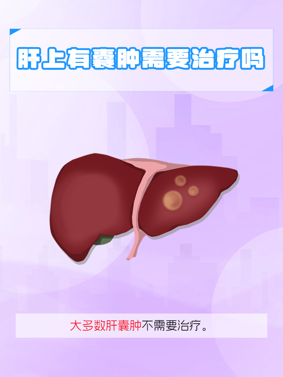 肝囊肿是怎么形成的?