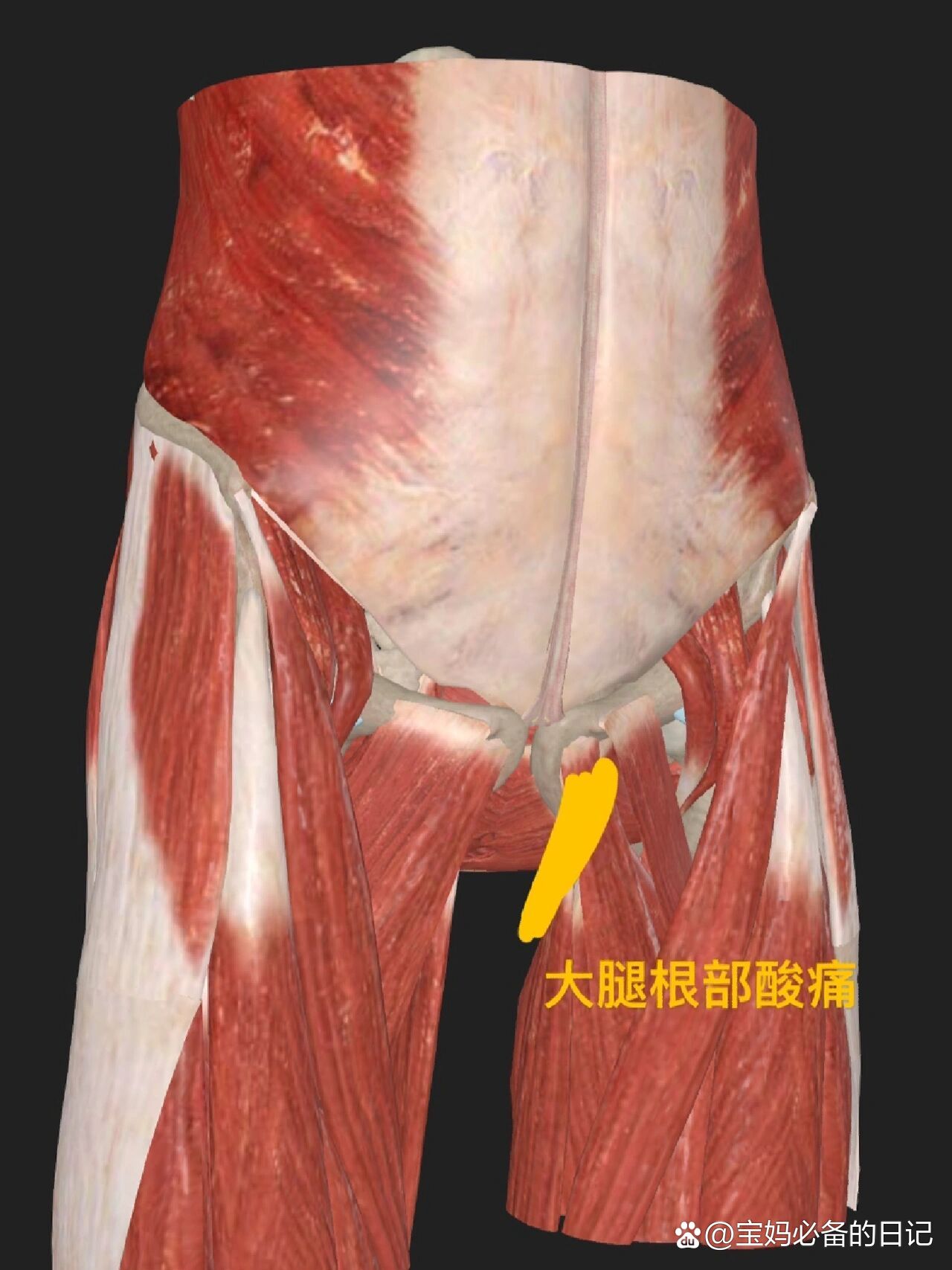 大腿内侧疼痛