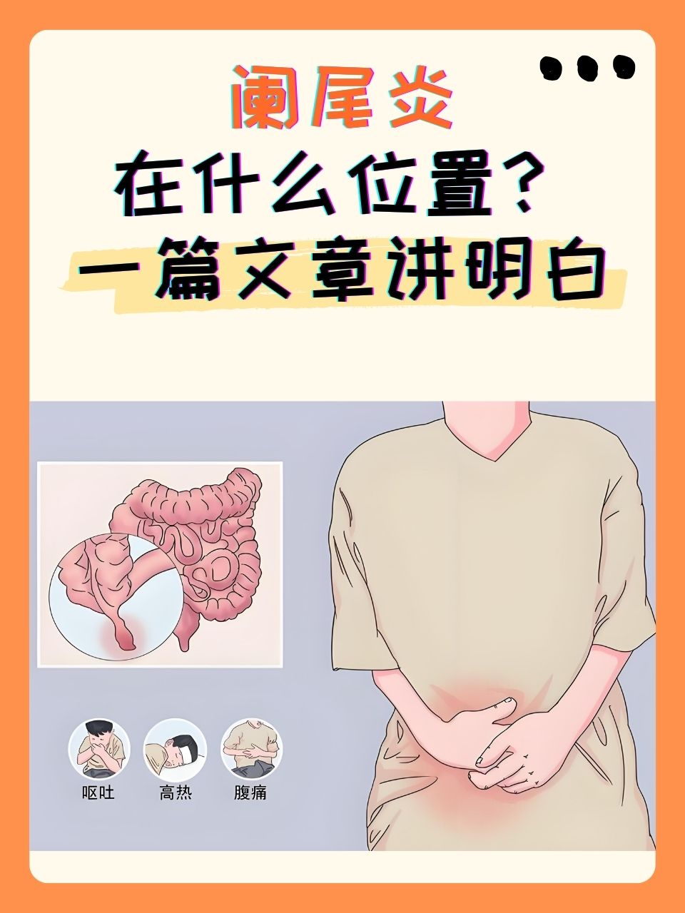 阑尾炎肚子哪边痛
