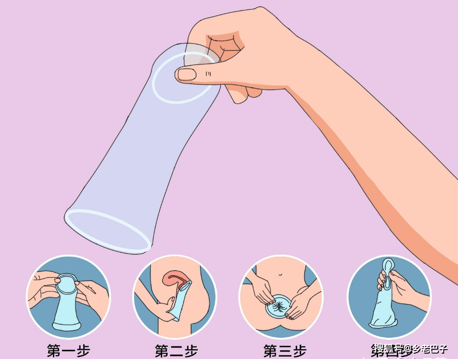 长期用避孕套有什么危害