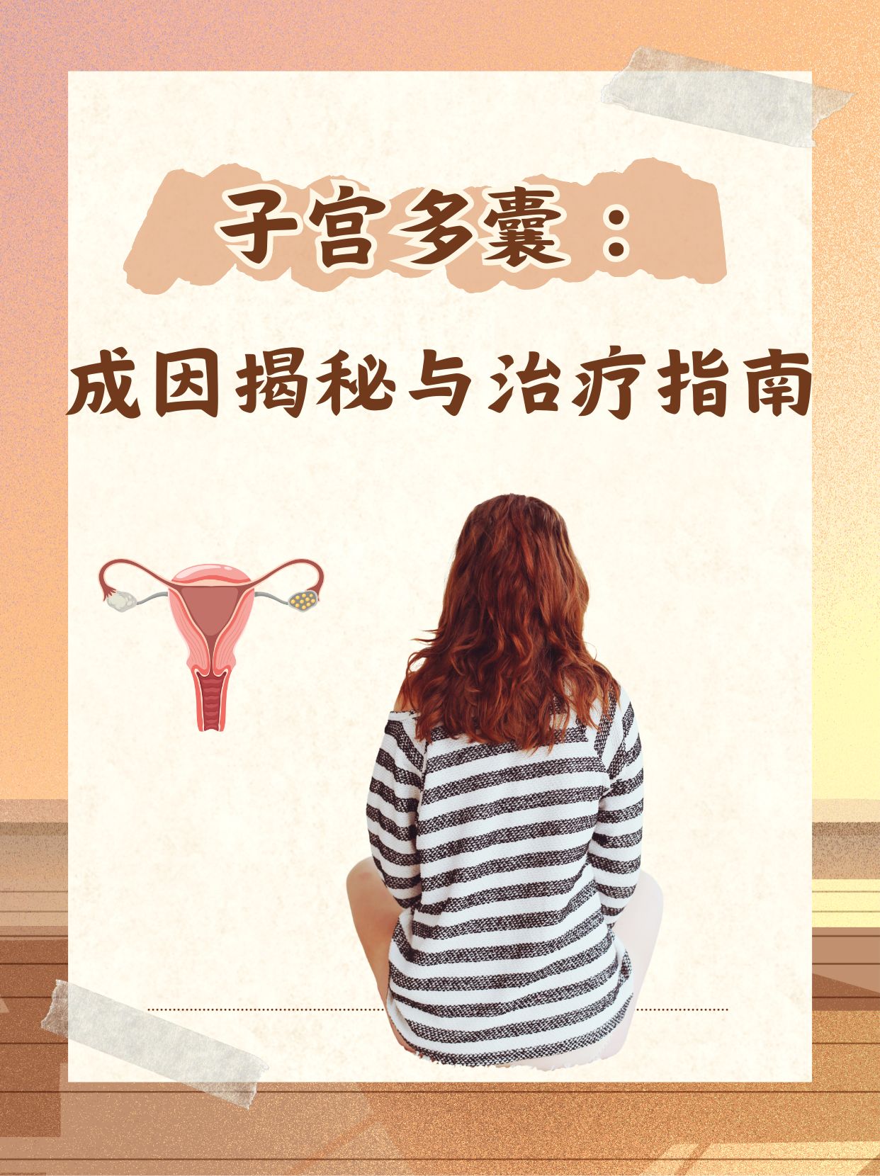 卵巢多囊样改变严重吗