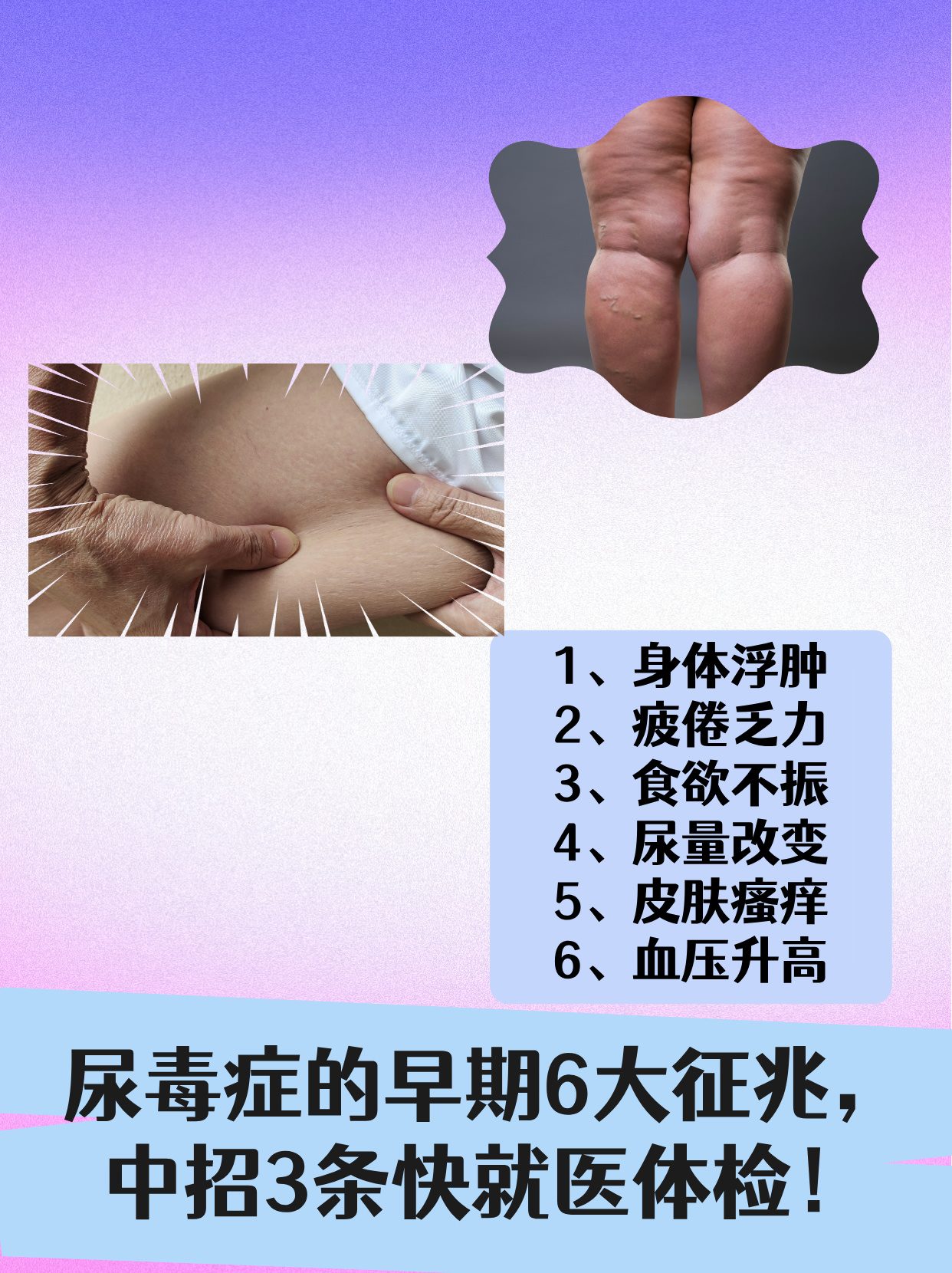 慢性肾衰竭的症状有哪些