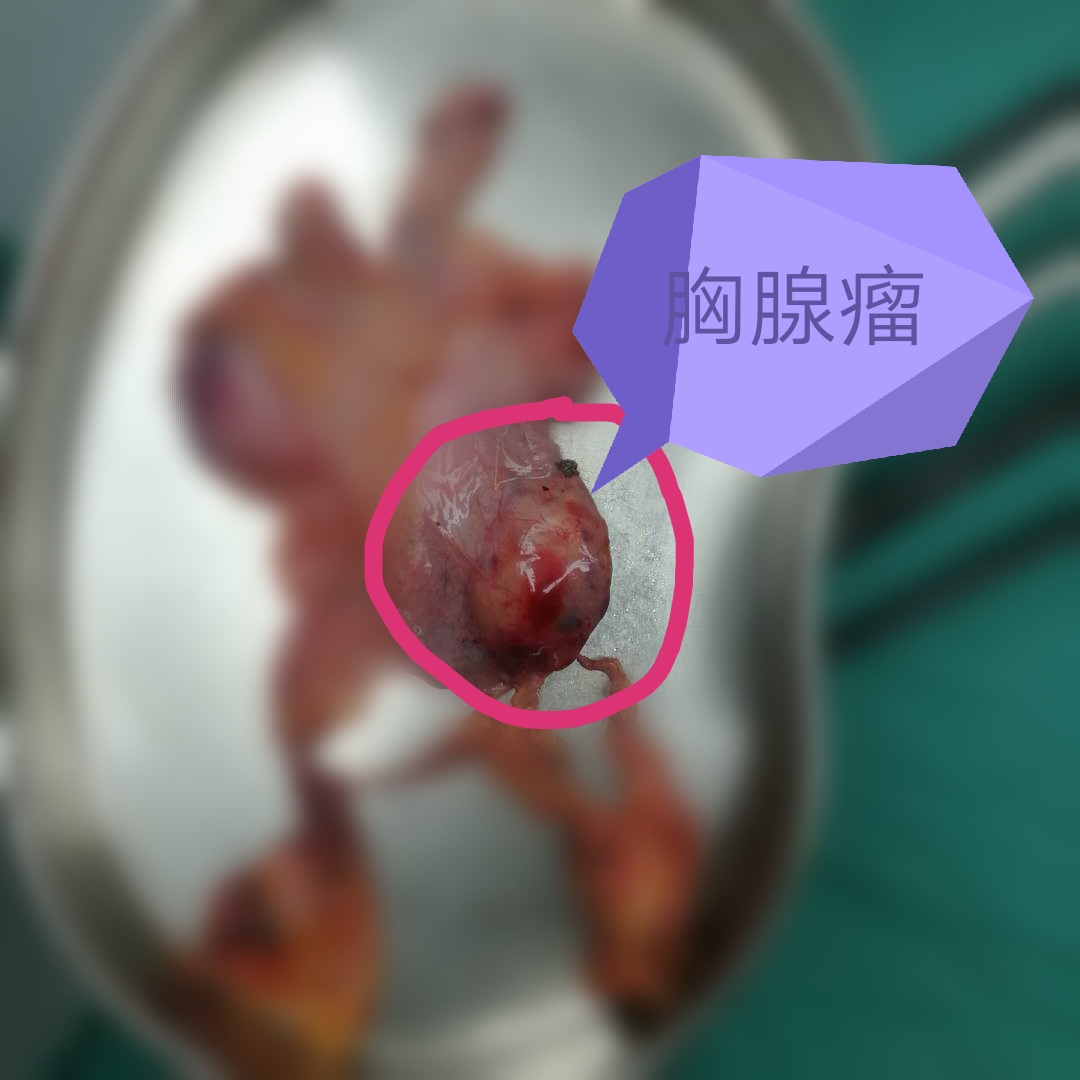什么是胸腺瘤