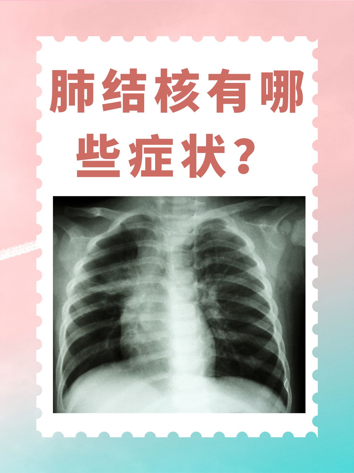 一般感染肺结核多久才会出现症状