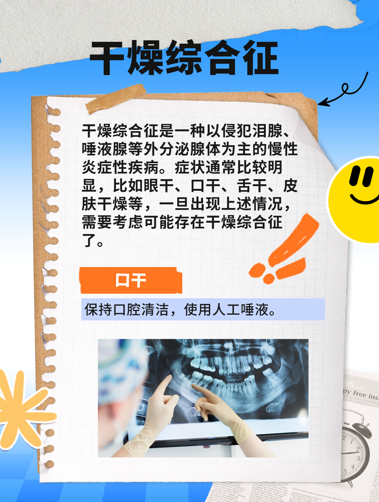 干燥综合征的概述