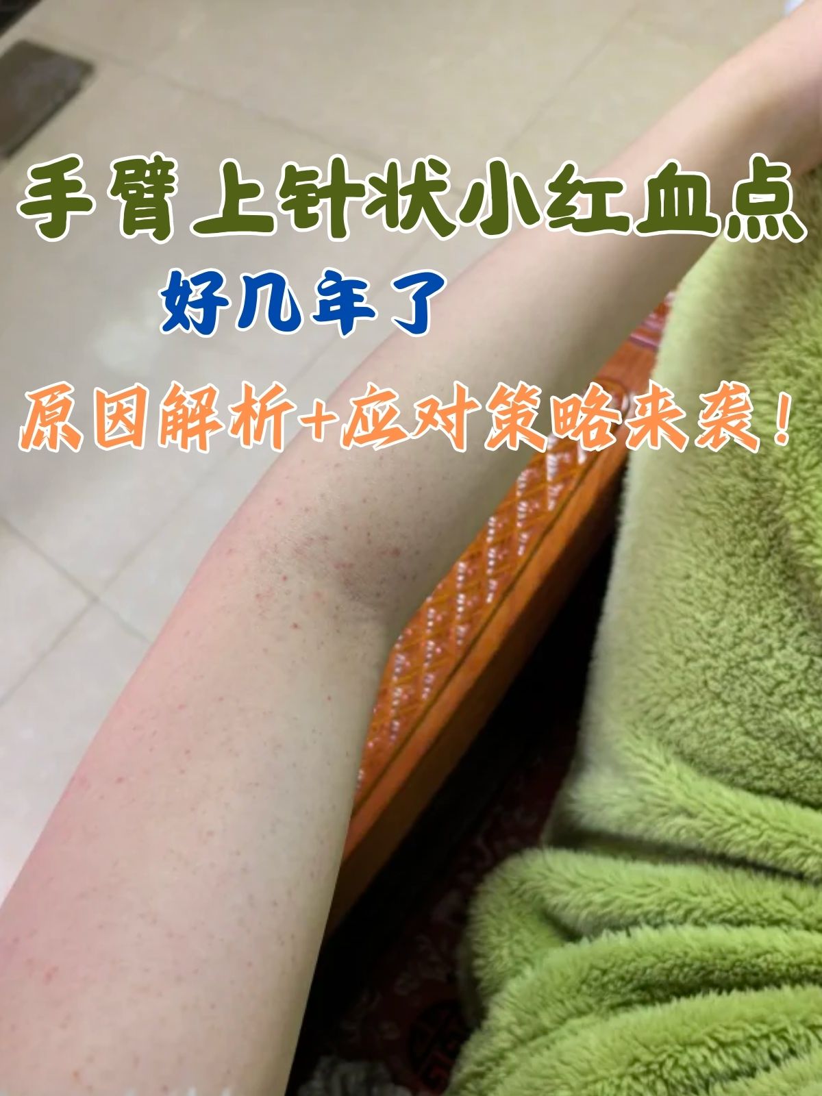 皮肤上有小红血点不痛不痒