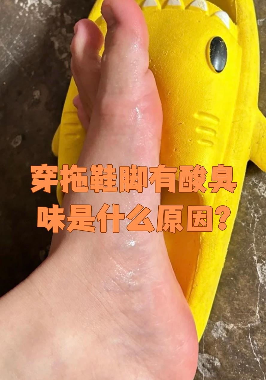 脚出汗多是肾虚吗