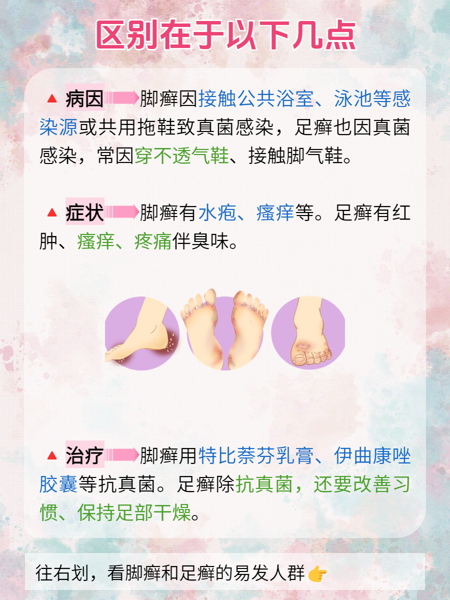 干脚气的治疗方法有哪些?