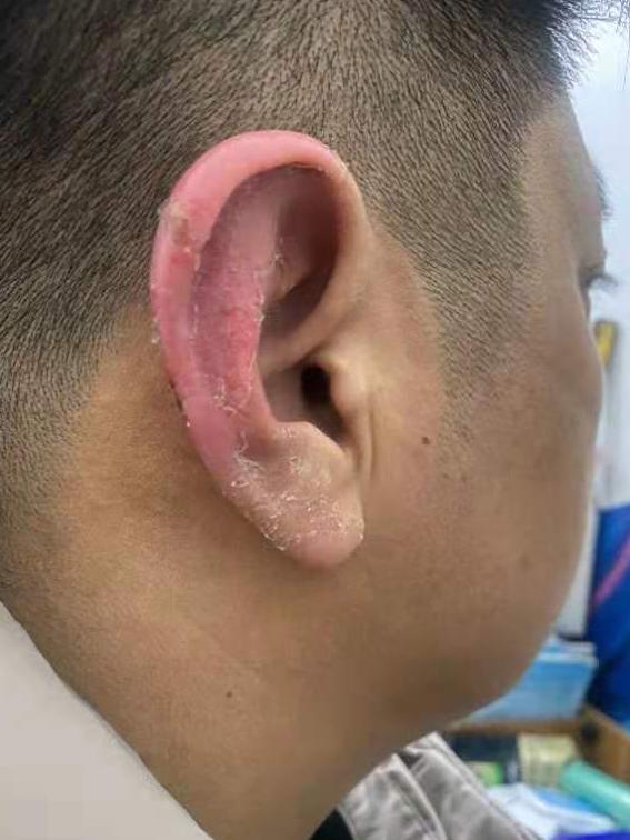 德雅爱