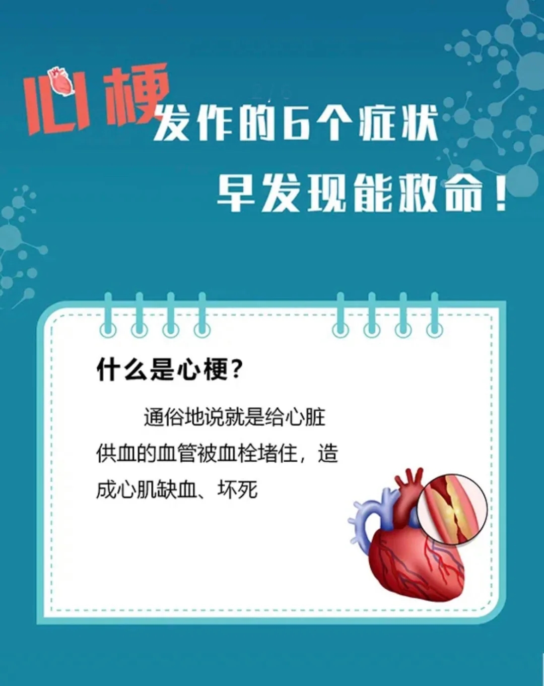 心肌梗塞的前兆和表现