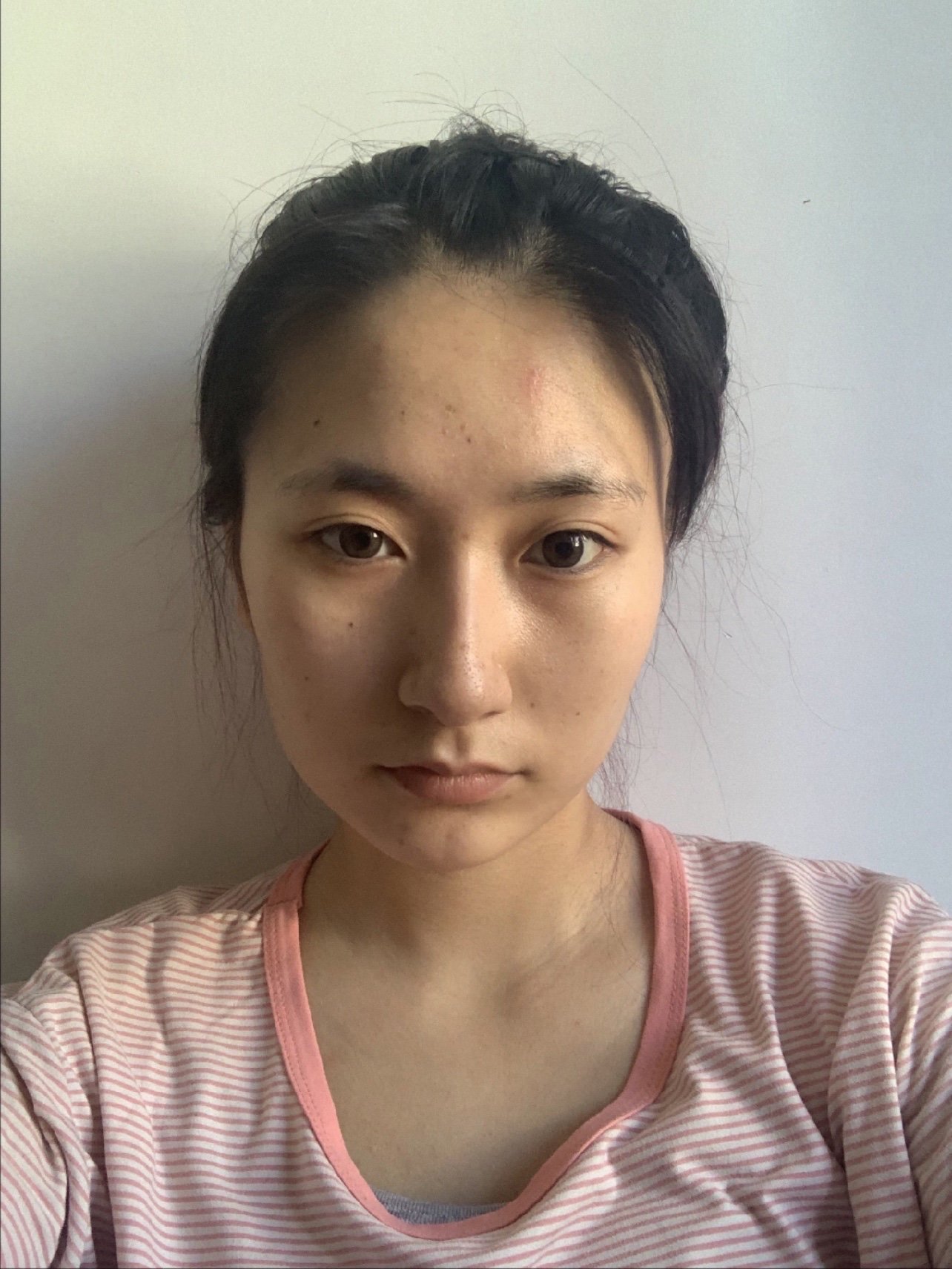 两边脸不对称,骨头也不对称