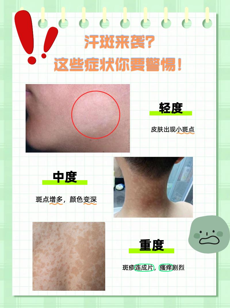 汗斑是怎么引起的呢?
