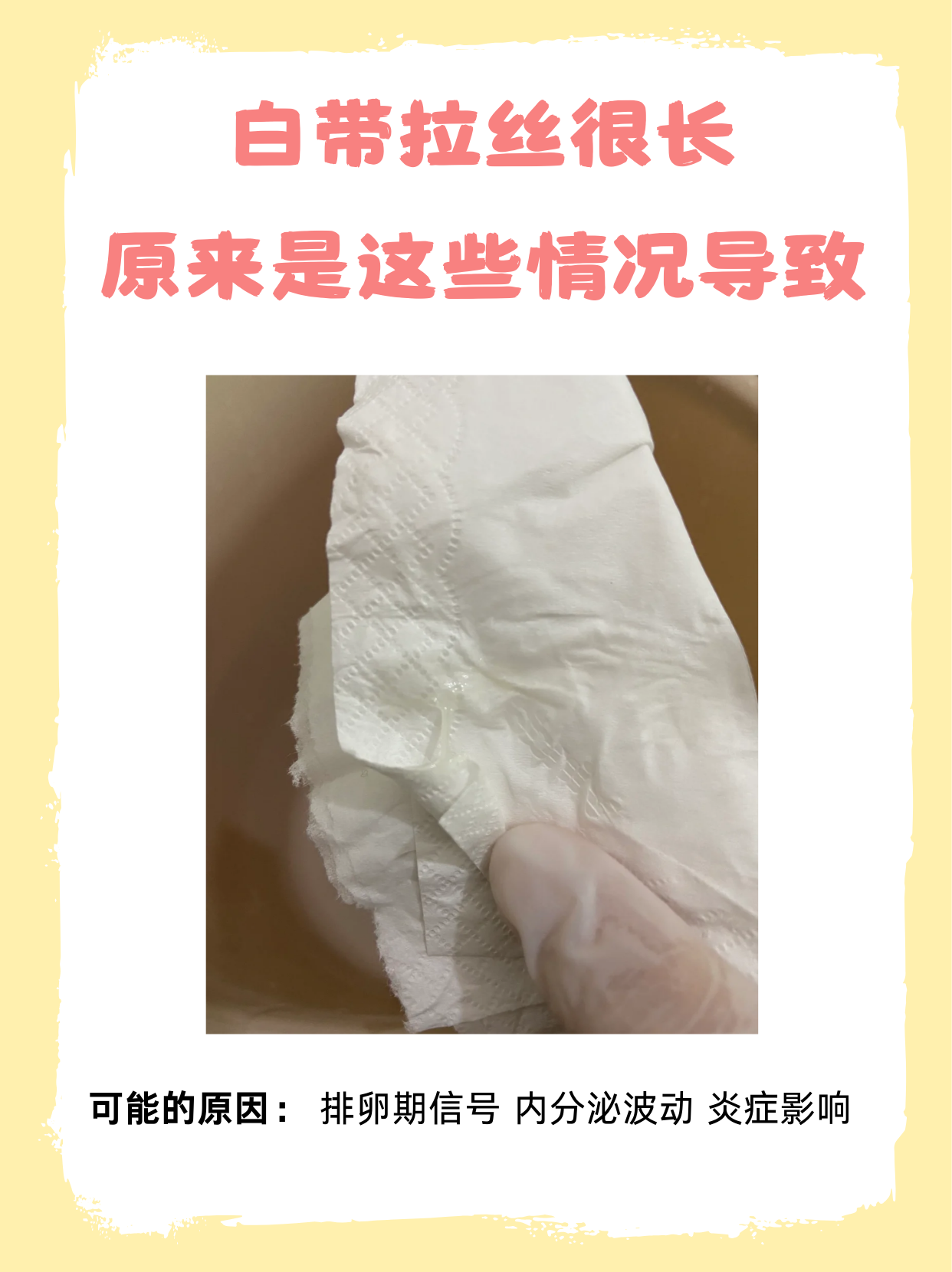 什么是白带拉丝