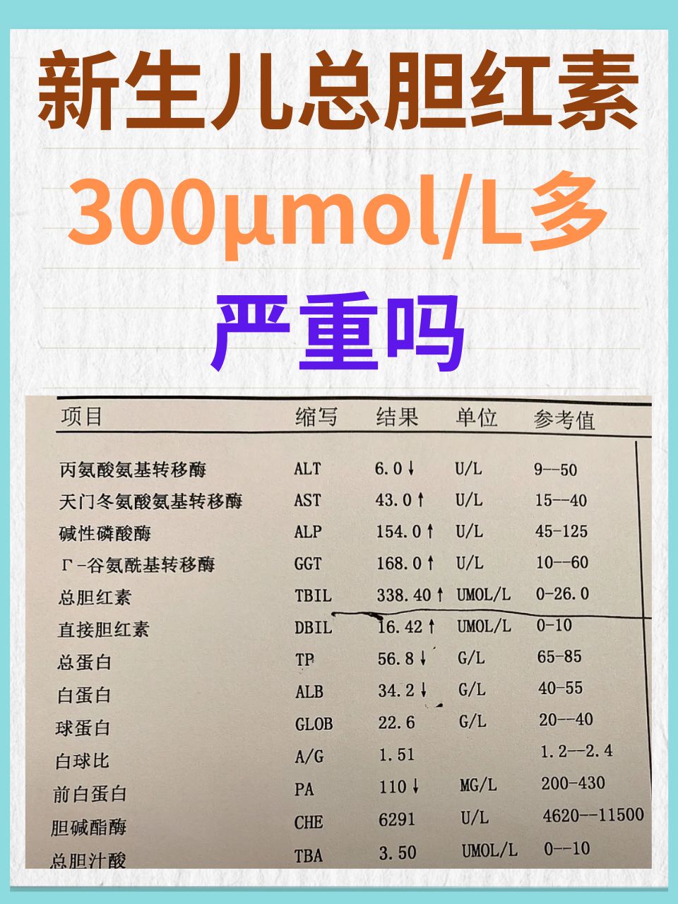 间接胆红素的正常值是多少