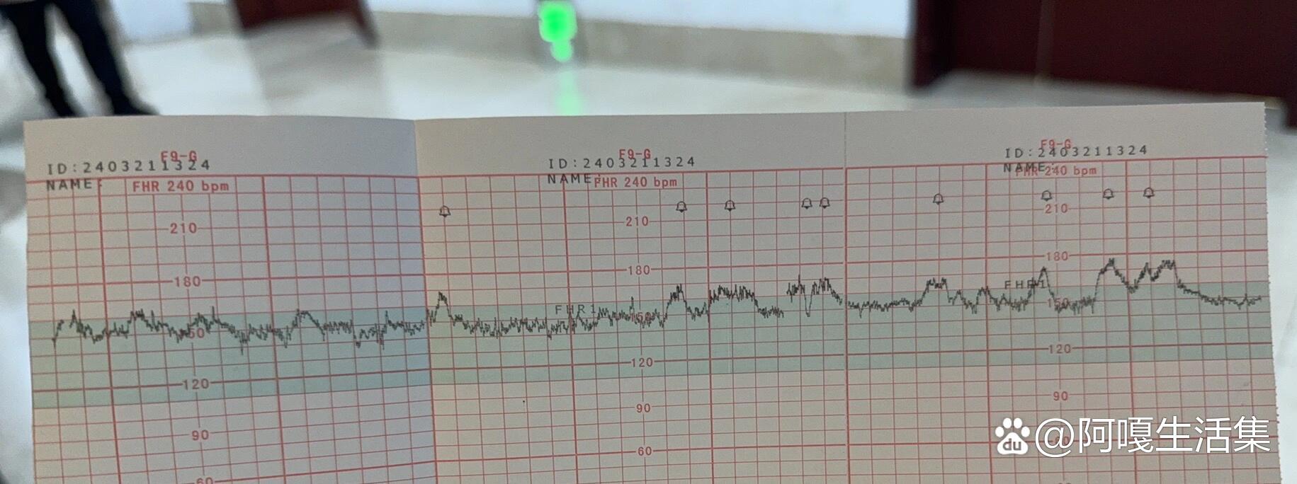 胎心监护不过关怎么办