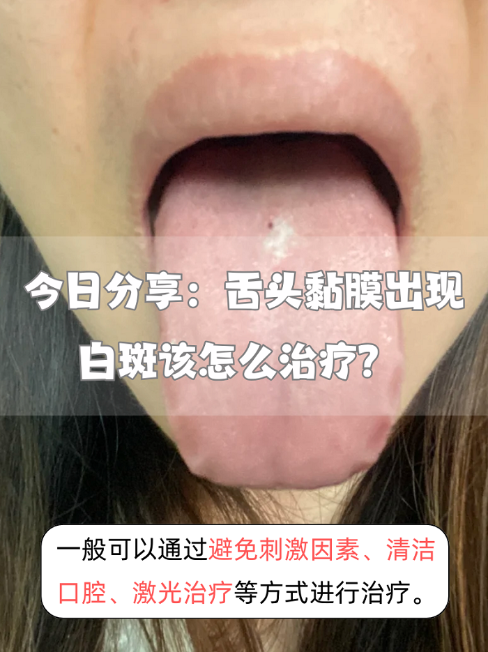 舌苔发白是什么原因?