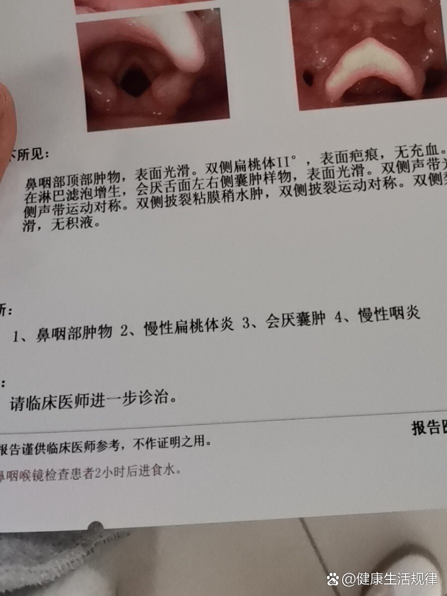 扁桃体摘除术多少钱