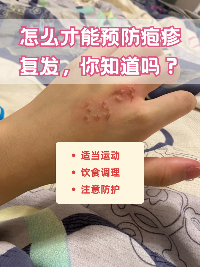 疱疹是什么样的?