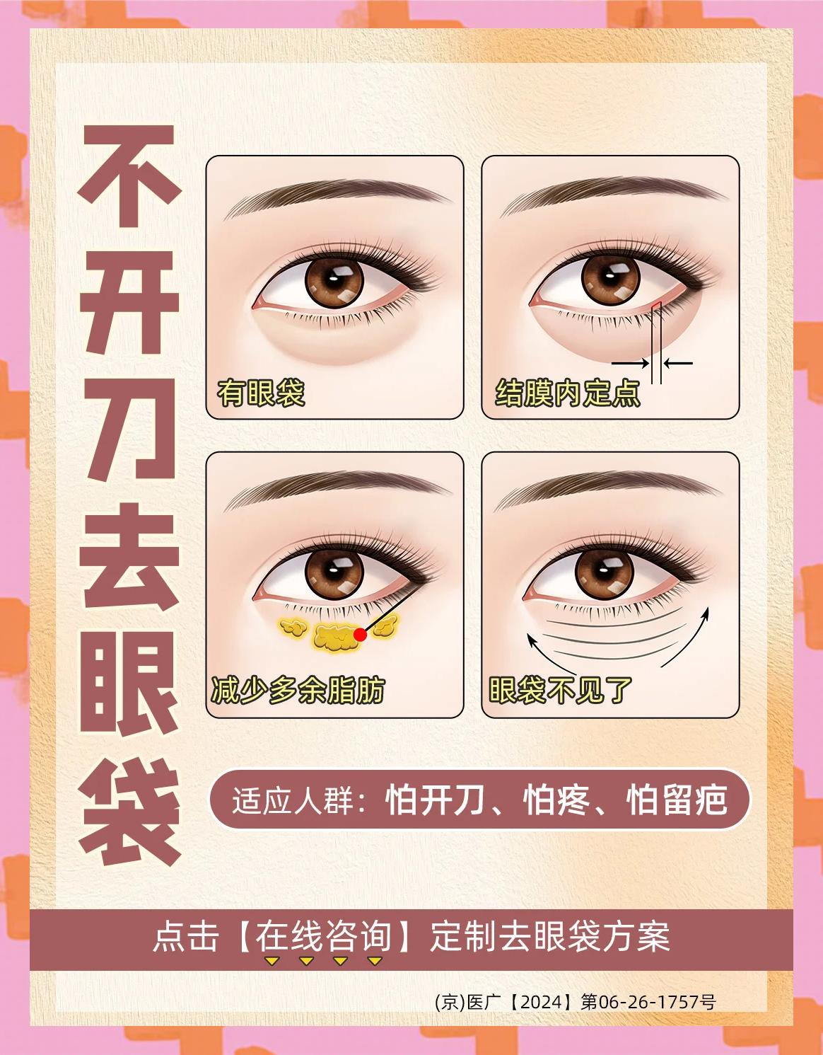 有眼袋怎么办