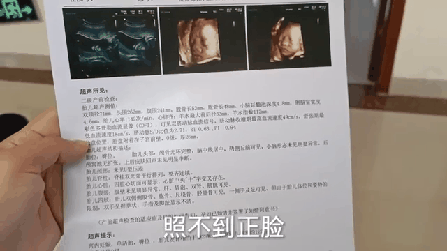 做彩超前能吃饭喝水吗
