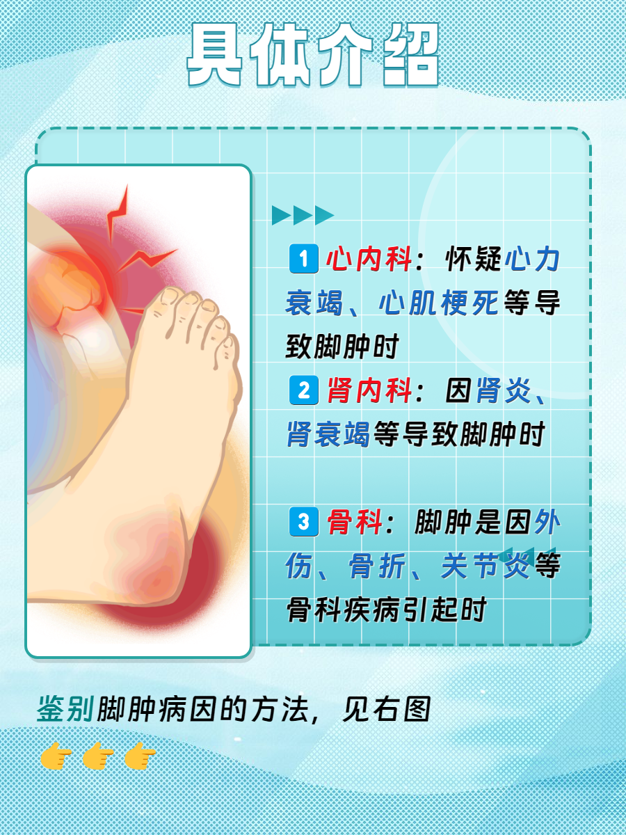 痛风脚肿怎么消肿止痛
