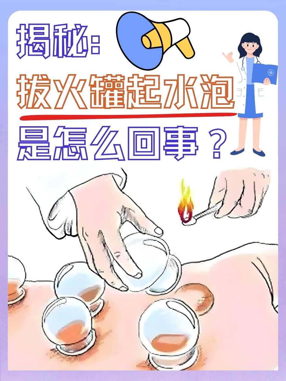 拔火罐起的水泡怎么办?