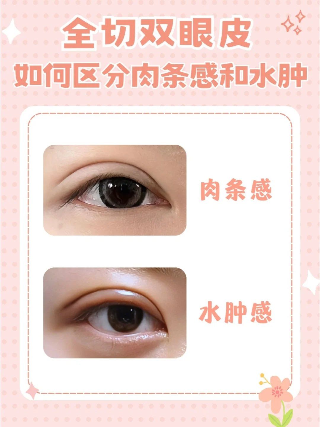 眼皮肿是怎么回事?