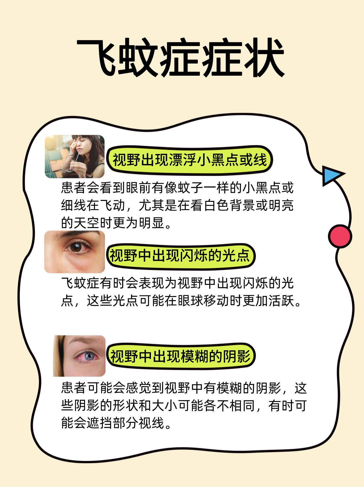 什么是飞蚊症?