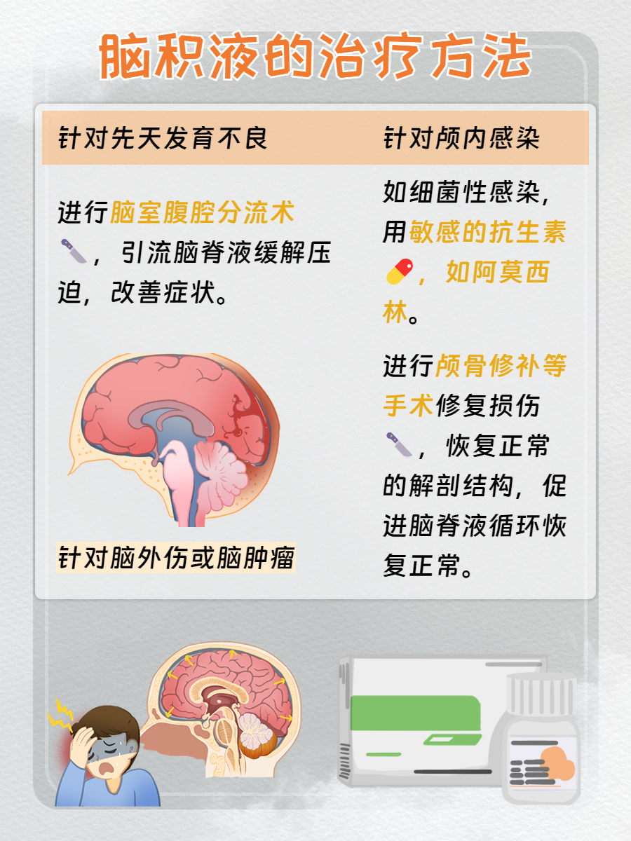 脑积水怎么治